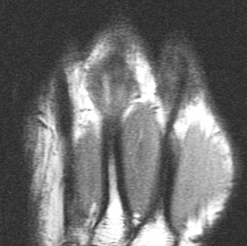 Figure 3 for case Boxers knuckle